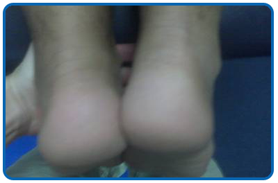 leg-length-unequal